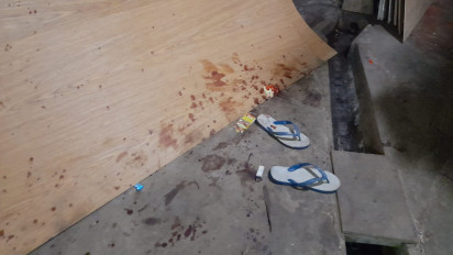 Anak Korban Pembunuhan Ciracas Ikut Terluka saat Lerai Orang Tuanya Bertengkar