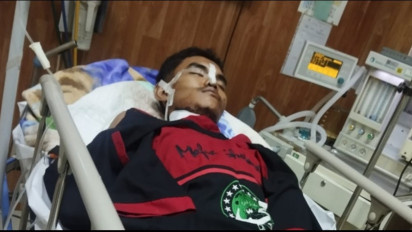 Hasil Tes Jiwa Anak Penggal Kepala Bapaknya di Jember, Pelaku Alami Gangguan Jiwa Berat