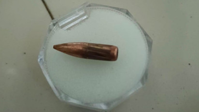 Istri Pensiunan TNI di Jember Ditembak OTK, Ini Kata Polisi