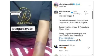 Viral ART Asal Banyumas Diduga Dianiaya Majikan di Jakarta Timur, Begini Kondisi Korban