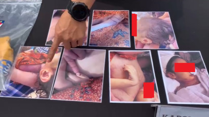 Terungkap, Motif Kekasih Ibu Siksa Balita hingga Tewas di Medan, Polisi Bocorkan Hasil Ekshumasi