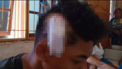 Tragis, Pelajar SMK Dibacok Otk di Puncak Waringin Labuan Bajo