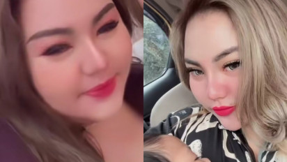 Terungkap Biaya Operasi Payudara Lisa Mariana: Eh, Ini Asli, Asli Dokter Maksudnya