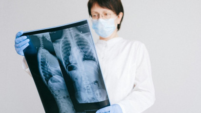 Usia Tua yang Rentan terhadap Penyakit, 3 Weton Ini Kesehatannya Berpotensi Terganggu Selama Bulan April 2025