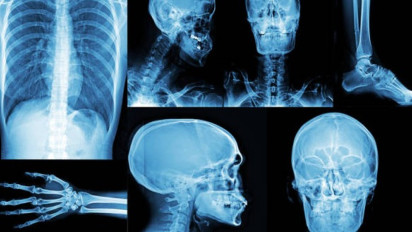 Cuma Gara-gara Hal Ini, Seorang Pria Rela Mutilasi Hampir Seluruh Bagian Wajahnya Cuma Demi Memuaskan...