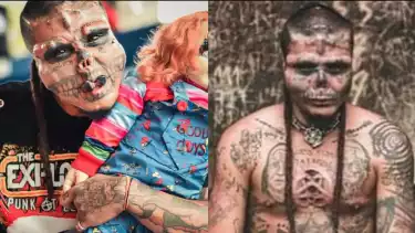 Cuma Gara-gara Hal Ini, Seorang Pria Rela Mutilasi Hampir Seluruh Bagian Wajahnya Cuma Demi Memuaskan...