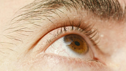 Kok Bisa Mata Wanita Ini Ditumbuhi Parasit setelah Berhubungan Intim, saat Diperiksa Ternyata...