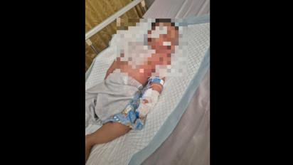 Diduga Salah Diagnosa. Kesehatan Balita Anak Komisioner Bawaslu Tuban Semakin Parah