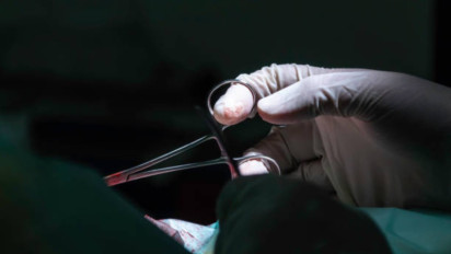 Hukum Vasektomi dalam Syariat Agama Islam Cuma Demi Penuhi Syarat Bansos, Jangan Dianggap Sepele!