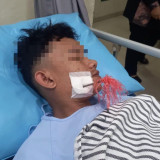 Diduga Salah Sasaran, Remaja Asal Palembang Terkena Anak Panah Saat Terjadi Tawuran