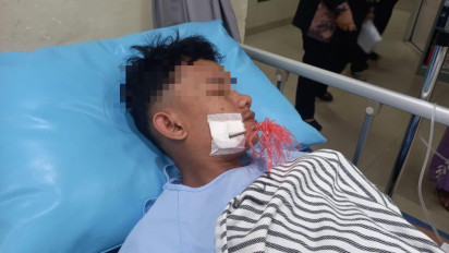 Diduga Salah Sasaran, Remaja Asal Palembang Terkena Anak Panah Saat Terjadi Tawuran