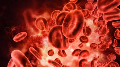 Akses Terapi Apheresis, Harapan Baru untuk Pasien Penyakit Darah dan Autoimun di Indonesia