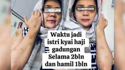 Wanita Ini Mengaku Jadi Korban Kekerasan Ustaz Kondang di Banyuwangi hingga Lebam-lebam di Sekujur Tubuhnya...