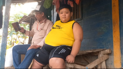 BPJS Tak Tanggung Biaya Penurunan Obesitas Bocah di Tuban