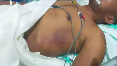 Prajurit Muda TNI AD Prada Lucky Tewas Penuh Luka Lebam