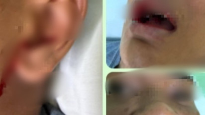 Diduga Dikeroyok Geng Sekolah, Siswa SMAN 1 Matauli Pandan Tapteng Babak Belur Masuk Rumah Sakit