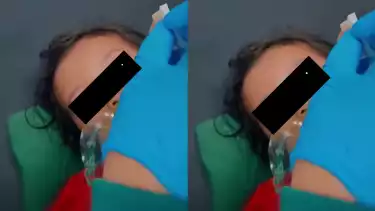 Balita meninggal karena cacingan