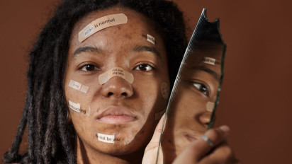 Waspada Wajah Kusam Bisa Jadi Tanda Diabetes, Dokter Ahli Sebut Ciri-cirinya