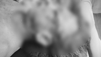 LBH Medan Desak Polisi Ungkap Penyebab Kematian Wartawan yang Tewas Penuh Luka