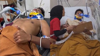 Tangan Kanan Erick Thohir di PSSI Pastikan Komisi Disiplin Turun Tangan Atas Cedera Fatal Pemain Persikad