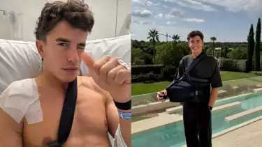 Kondisi Marc Marquez pasca jalani operasi usai crash di MotoGP Mandalika 2025