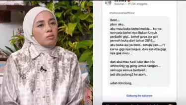 Melda Safitri dihujat netizen karena behel gigi