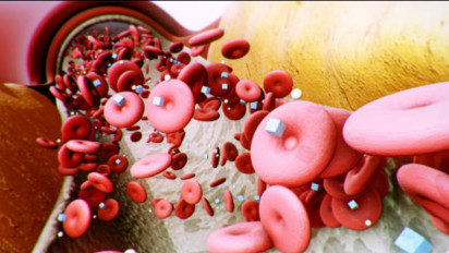 Diabetes Bisa Dicegah! Begini Cara Lindungi Diri dari Komplikasi Kebutaan yang Mengintai