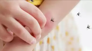 Apa Perbedaan Panas Badan karena Demam Biasa dengan Demam Berdarah Dengue (DBD)?