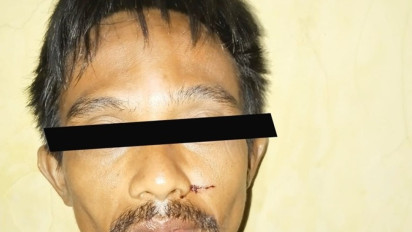 Pelaku Pembacokan Sadis di Jakarta Pusat dalam Pengaruh Alkohol, Sempat Minum Bareng Korban