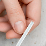 Kenali Penyebab Cantengan dan Cara Mengatasinya dengan Tepat agar Tidak Semakin Parah dan Terinfeksi