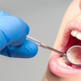 Waspada Masalah Kesehatan Gigi dan Mulut: Masih Sikat Gigi dengan Cara Lama? Dokter Ungkap Kesalahan Umum yang Bikin Gigi Kuning