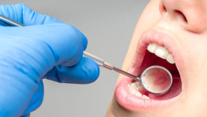 Waspada Masalah Kesehatan Gigi dan Mulut: Masih Sikat Gigi dengan Cara Lama? Dokter Ungkap Kesalahan Umum yang Bikin Gigi Kuning