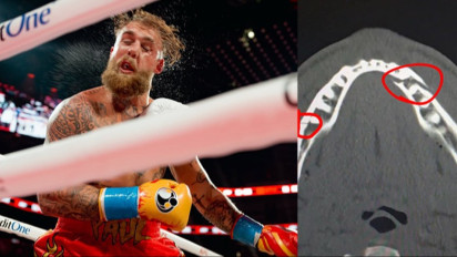 Peringatan Legenda UFC Benar-benar Terbukti, Jake Paul Alami Cedera Rahang usai Duel Lawan Joshua