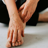 Tiga Bahan Alami yang Efektif untuk Menghilangkan Kurap di Kulit, Salah Satunya Kunyit!