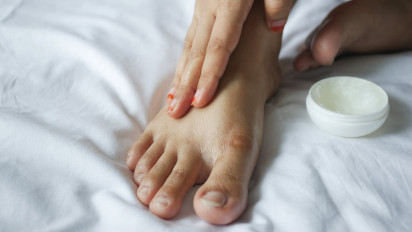 3 Obat yang Ampuh Atasi Kutu Air, Bisa Ditemukan dengan Mudah di Apotek