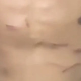 Bekas Luka Tendangan "Kungfu" Pemain Liga 4 PS Putra Jaya Hilman Gimnastiar