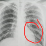 Pemain Putra Jaya Pasuruan yang Tendang Lawan Dikeluarkan dari Klub, Korban Alami Retak Tulang Dada