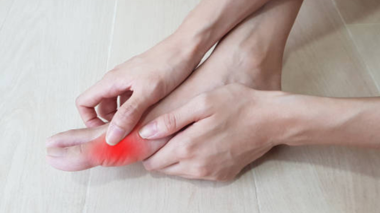 Asam Urat Tak Datang Tiba-Tiba, Begini Cara Menjaga Kadar Purin Tetap Normal dan Nyeri Tak Datang Mendadak
            - galeri foto