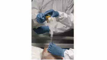 Ilustrasi - Penggunaan Nitrous Oxide dalam dunia medis