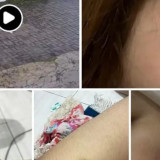 Viral! Mahasiswa Keperawatan di Yogyakarta Diduga Aniaya Pacar, Fakta Terungkap Lewat Unggahan Sang Kakak