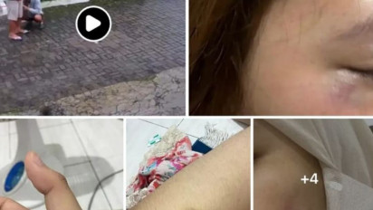Viral! Mahasiswa Keperawatan di Yogyakarta Diduga Aniaya Pacar, Fakta Terungkap Lewat Unggahan Sang Kakak