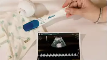 Chelsea Islan umumkan kehamilan anak pertama