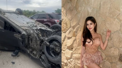 Diva Siregar Kecelakaan di Tol Jagorawi, Polisi Sebut Sang Model Alami Microsleep hingga Tabrak Pembatas Jalan