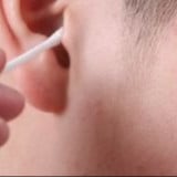 Jangan Lagi Korek Telinga saat Puasa Ramadhan, Buya Yahya Ingatkan ini Sebelum Menyesal