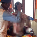 Pemuda di Plampang Dibakar Ibu Kandungnya, Pertalite Disiram ke Tubuh Anak Saat Tertidur
