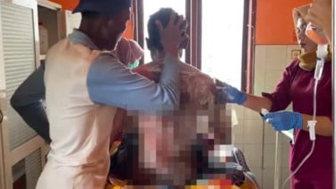 Pemuda di Plampang Dibakar Ibu Kandungnya, Pertalite Disiram ke Tubuh Anak Saat Tertidur