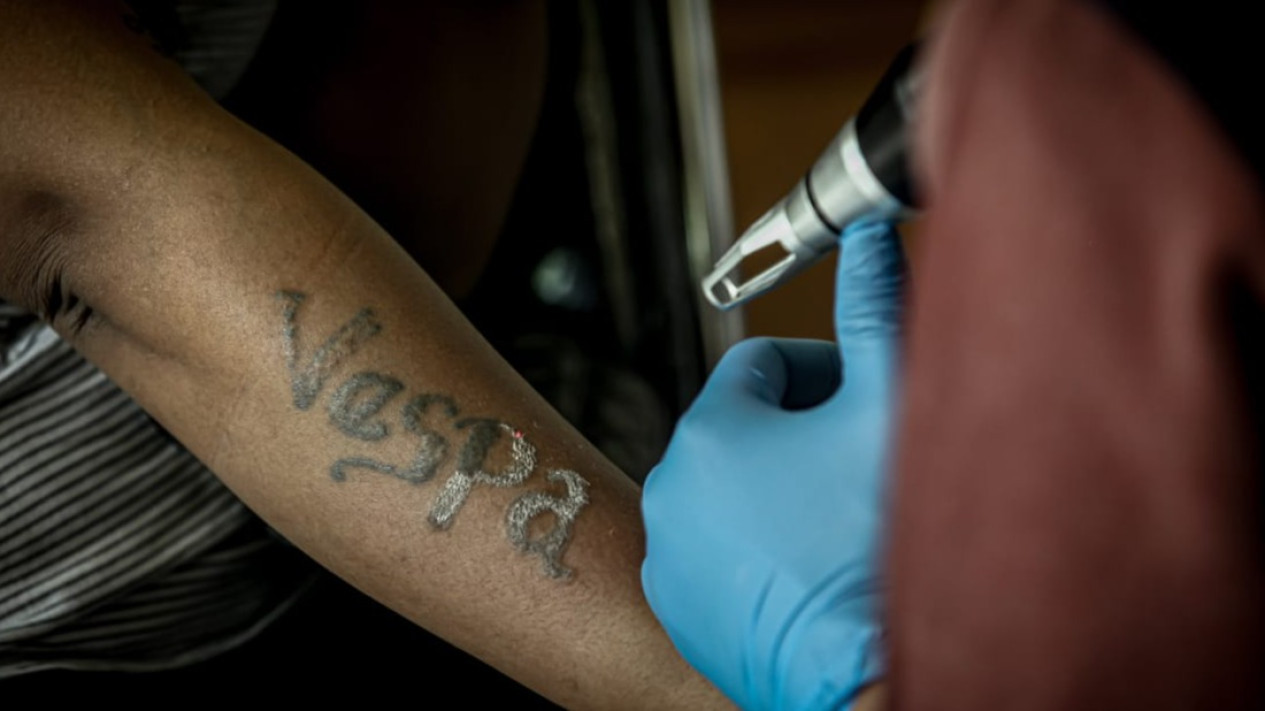 Berita Foto: Antusiasme Warga Padati Program Hapus Tato Gratis
            - galeri foto