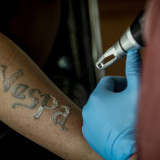 Berita Foto: Antusiasme Warga Padati Program Hapus Tato Gratis