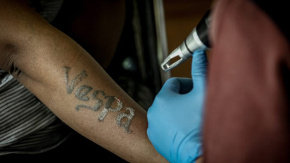 Berita Foto: Antusiasme Warga Padati Program Hapus Tato Gratis