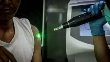 Berita Foto: Antusiasme Warga Padati Program Hapus Tato Gratis